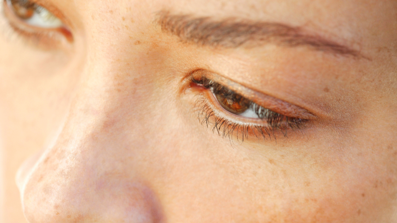 涙袋ヒアルロン酸はどのくらいもつ？持続期間と長持ちの秘訣