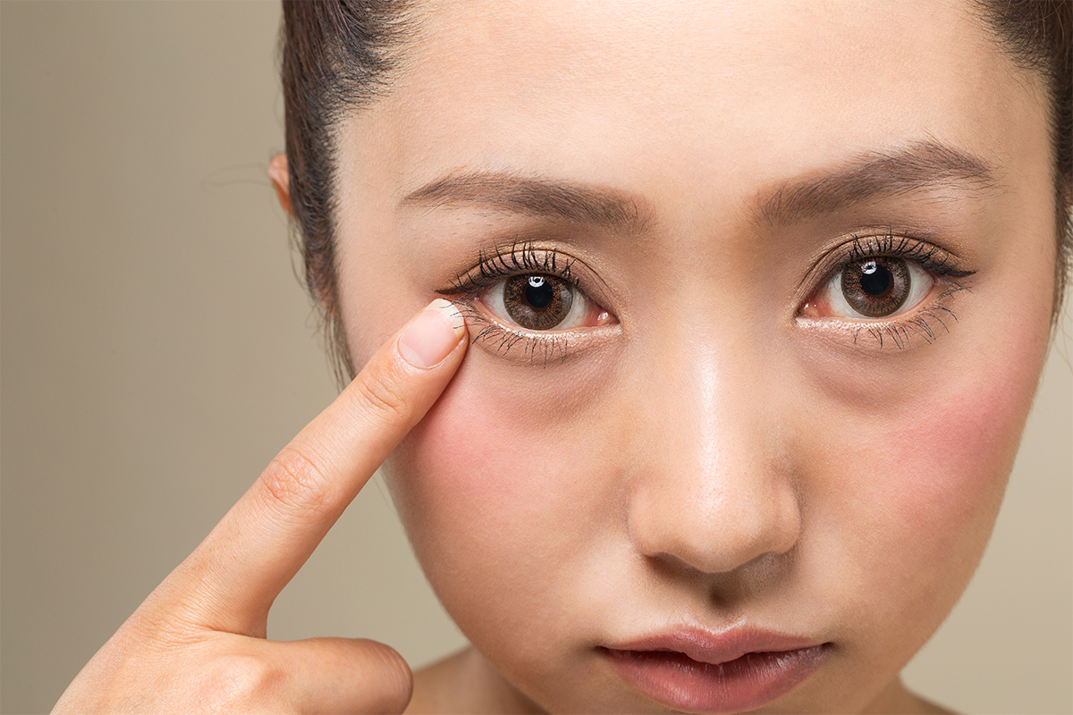 第1章 目の下のクマと涙袋の決定的な違いとは