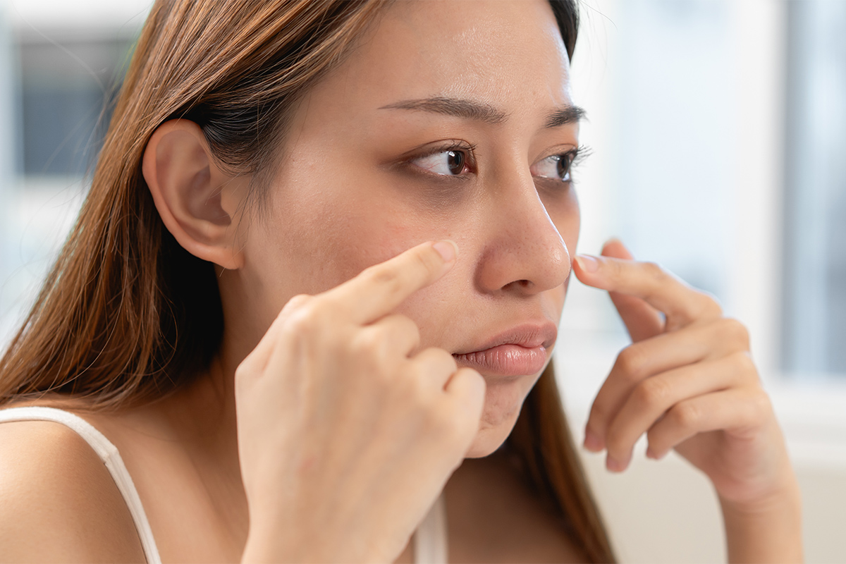 2-4. 黒クマ（影クマ）の根本原因