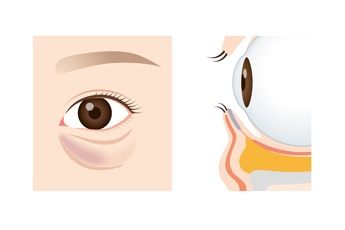 1-1. 青クマとは皮膚の下で透けて見える「静脈」