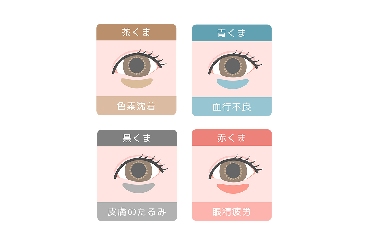 第1章 女性の目の下のクマの原因とは