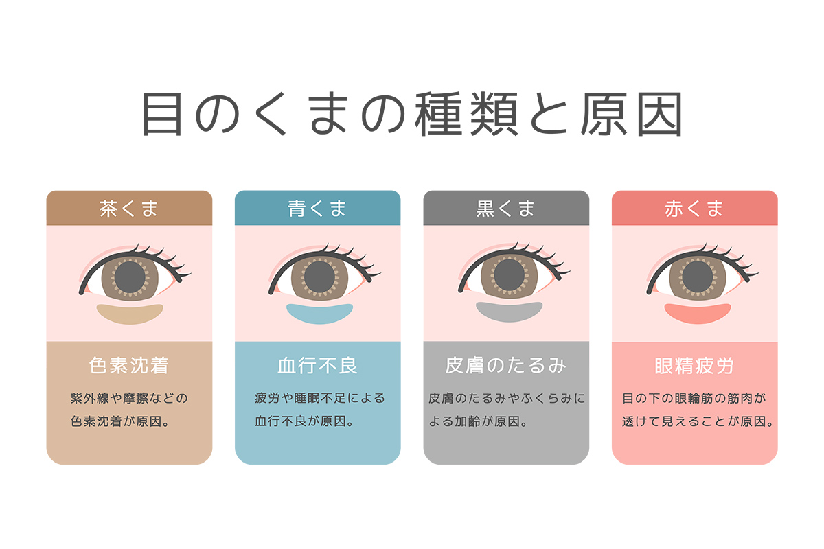 第4章 目の下のクマは4種類！