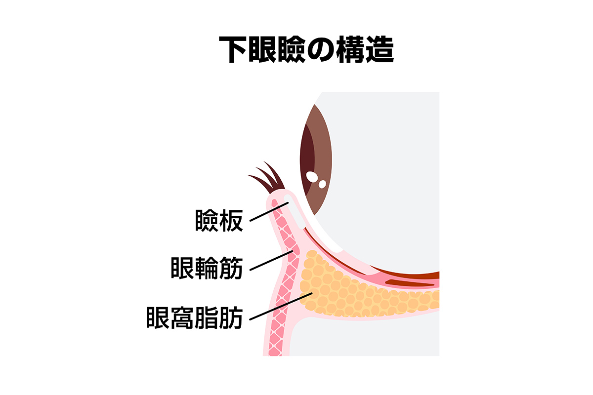 第1章 「切らないクマ取り」＝メスを使わないクマ取り？