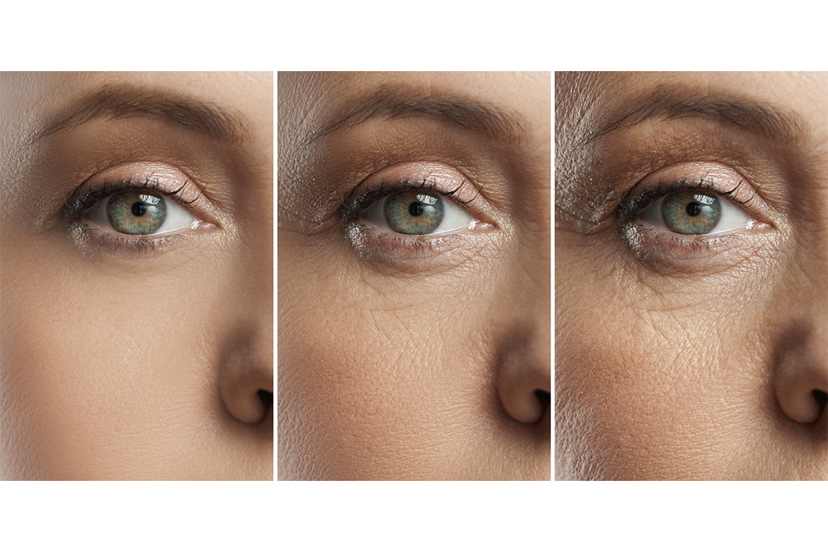 第6章 切らないクマ取りに関するQ&A