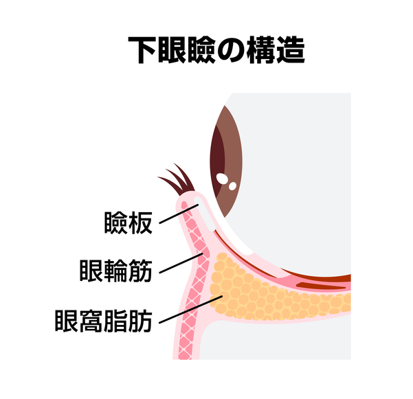 第1章 表ハムラ(切開ハムラ)の傷跡はどこにできる?