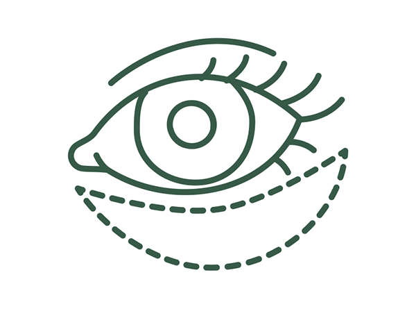 切らないクマ取り