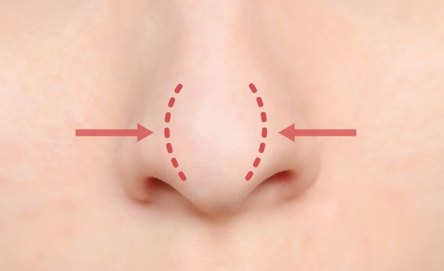 鼻尖形成について