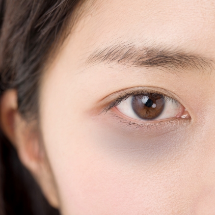 目周りに高い治療効果