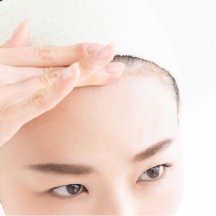 おでこの丸み形成・こめかみの凹み修正