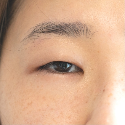 皮膚そのものが厚い