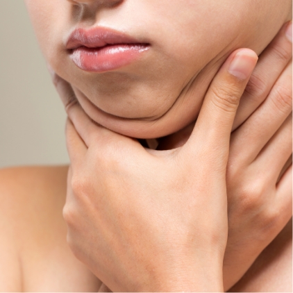 皮下脂肪が多い