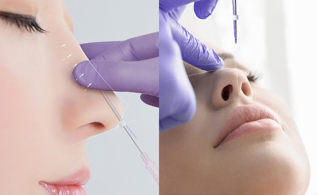 鼻メッシュ(テスリフトノーズ)について