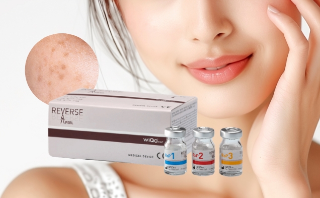 リバースピール(肝斑ピーリング)