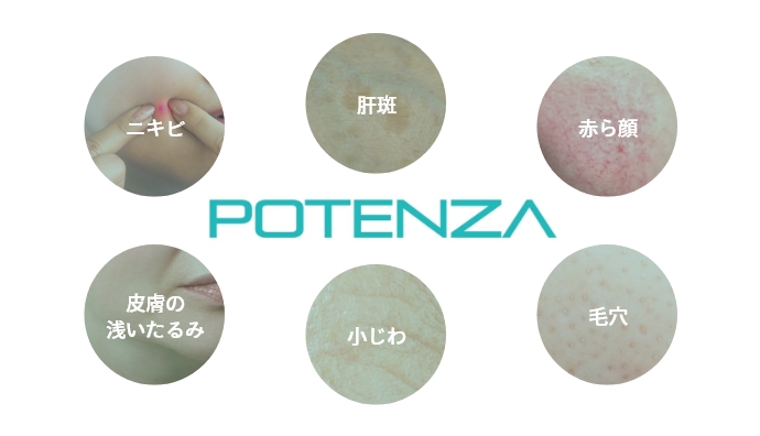ポテンツァは様々なお肌トラブルに対応
