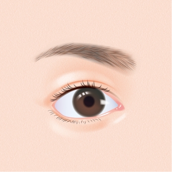 瞼板を下げることで、タレ目になります。