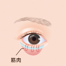 瞼板と筋肉を縫合します。