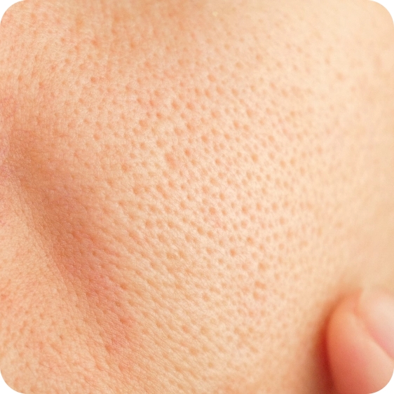 毛穴の引き締め