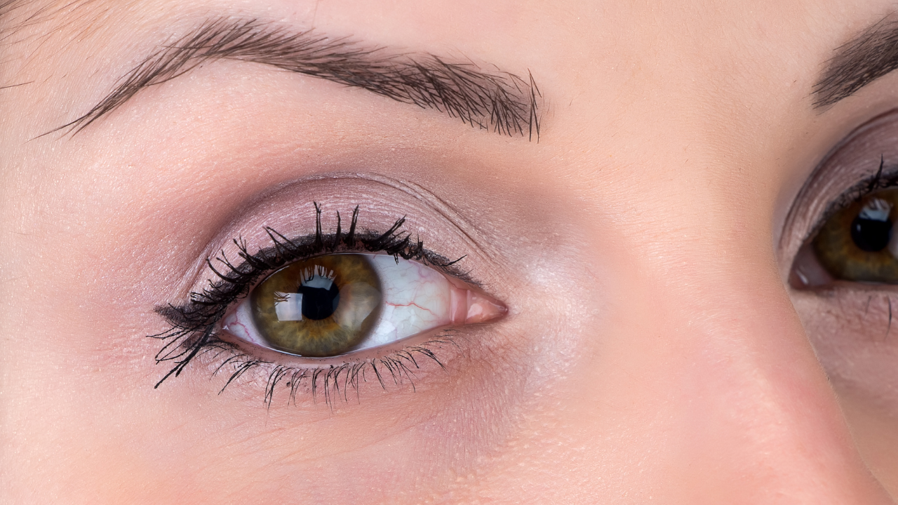 目頭切開で後悔しないために知るべきポイント